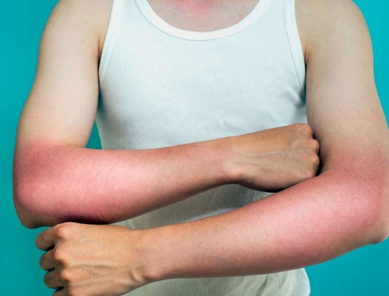 How To Stay Sun Safe At Work